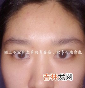 算命的说我犯婚煞是什么意思_额头、火星丘黑痣、生命线岛纹及聪明痣详解