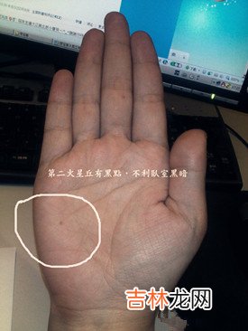 算命的说我犯婚煞是什么意思_额头、火星丘黑痣、生命线岛纹及聪明痣详解