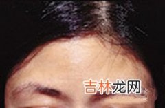 九星算命准吗_绣眉、女强人相、连眉、生命线截断解析