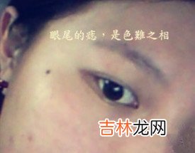 沙漠王子算命_眼圈发黑、红鼻子、口边痣、眼尾痣图解