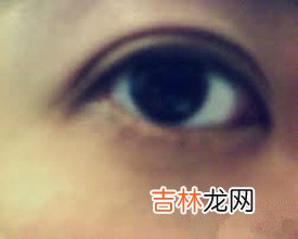 沙漠王子算命_眼圈发黑、红鼻子、口边痣、眼尾痣图解