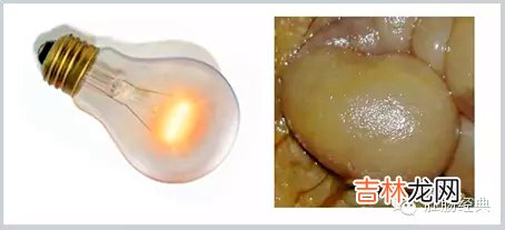 痔疮图片和正常图片的对比 痔疮图片和正常图片