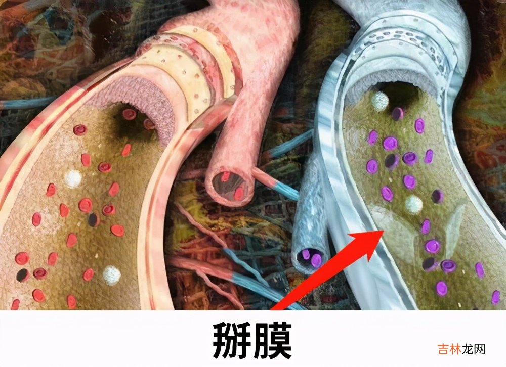 提肛运动怎么做才正确图片男 提肛运动怎么做才正确图片