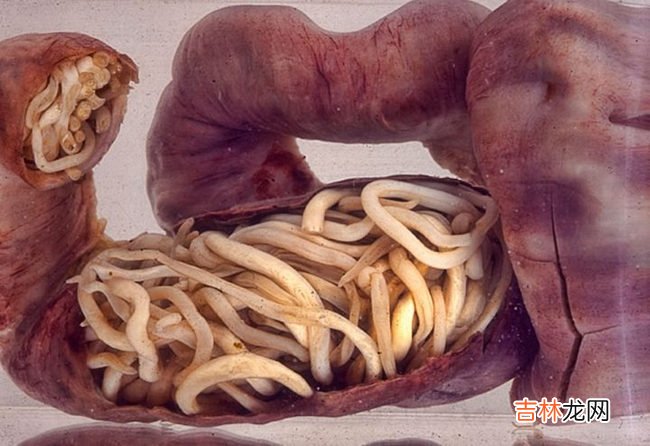 世界上十大最恶心的寄生虫 非常恶心恐怖