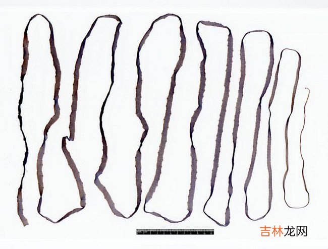 世界上十大最恶心的寄生虫 非常恶心恐怖