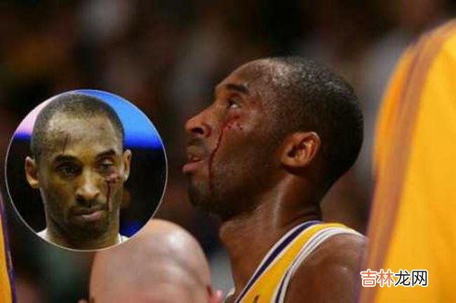 Nba十大打架事件 最严重的被凑出了脑浆