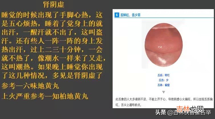 肾阴虚 肾阳虚和肾阴虚有什么区别症状百度百科