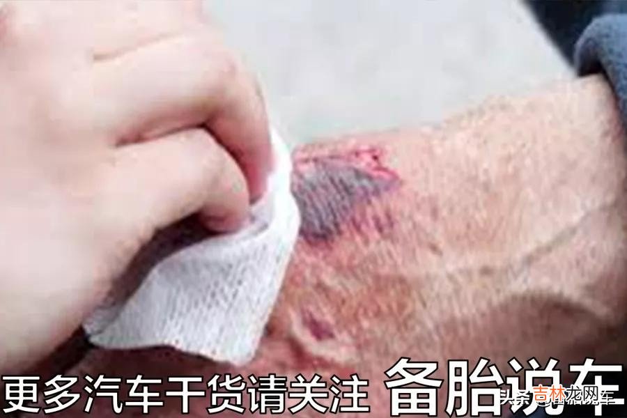 车损险不计免赔和第三者不计免赔 车险不计免赔险是什么意思