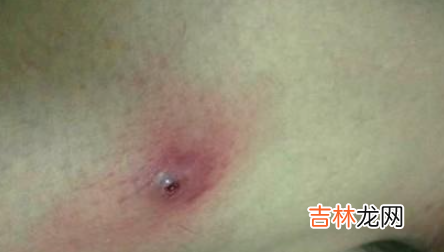天南星的功效与作用