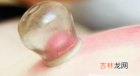 拔火罐后有哪些颜色