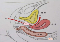 石女是啥意思-石女的病因是什么？