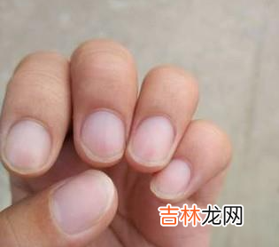 指甲有白点暗示什么疾病