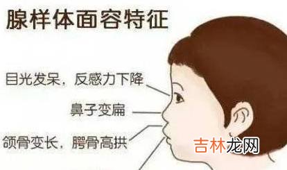 嗳乐蓓贝丨宝宝睡觉如果有这个习惯,可能影响孩子智力发育