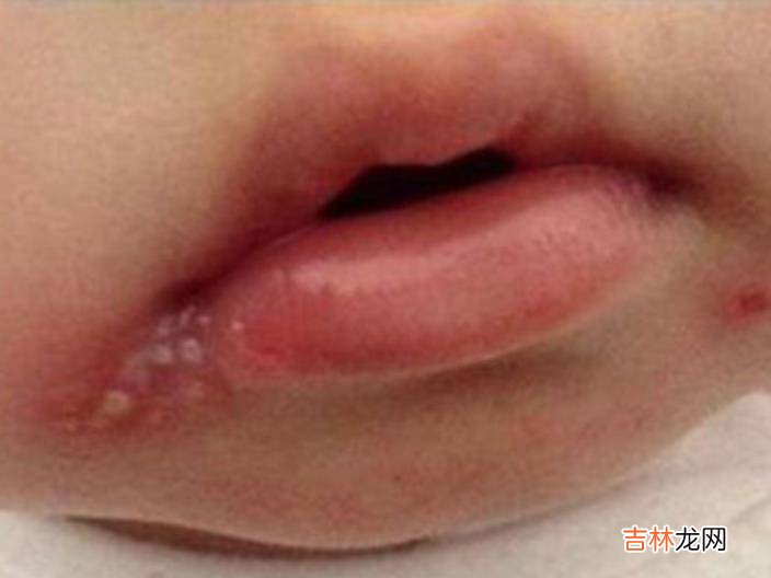 秋季防上火，帮助宝宝除秋燥，养育健康宝宝，这些过程都少不得