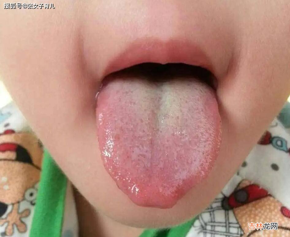 宝宝积食消化不良怎么办呢？可以喂健胃消食片么？这是治标不治本