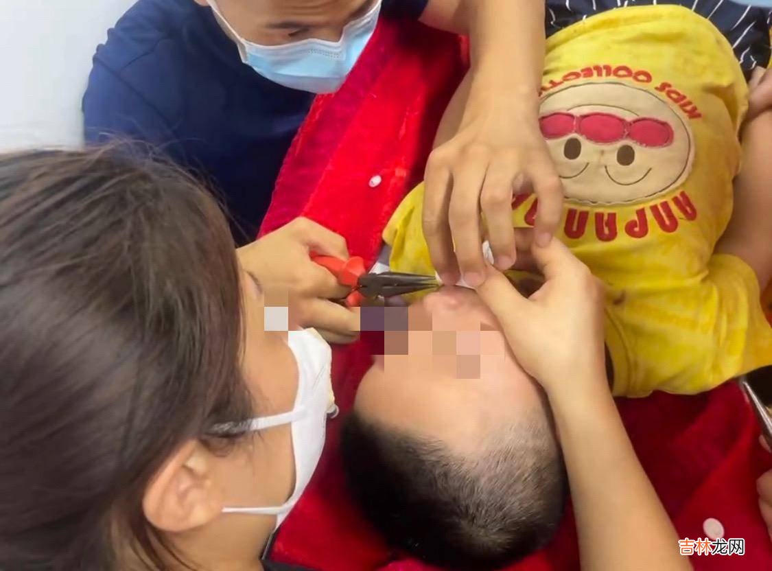 警惕！电动指甲刀又伤人，男童打麻药后消防员拆除