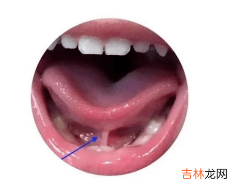 护牙小科普 | 0-18岁应该关注的口腔问题