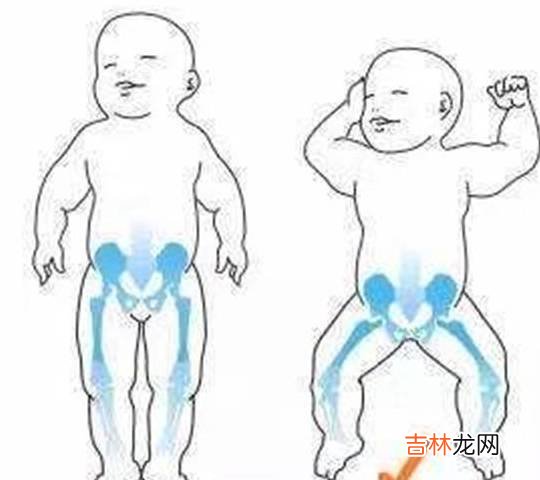 老人为预防罗圈腿，结果把我绑成“X”型腿，如今又要绑我的宝宝