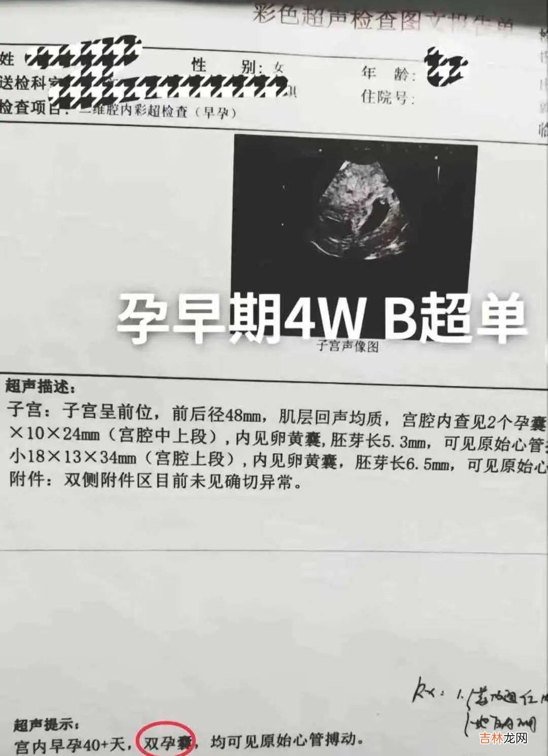 大衣哥儿媳怀双胞胎！女方是二婚，网友怀疑孩子不是朱小伟的？