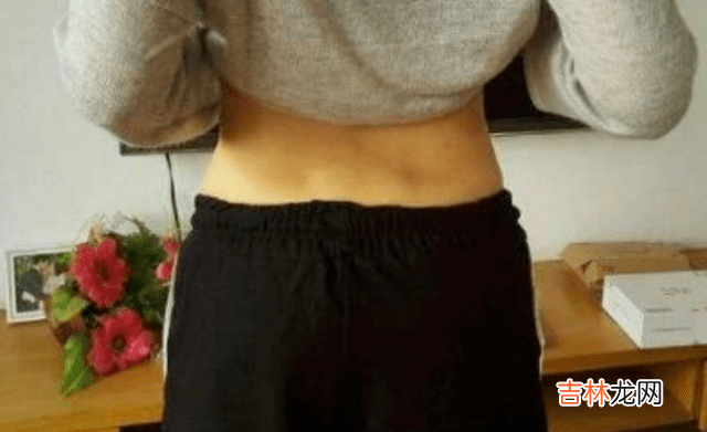 女人后腰上的“两个凹点”到底是什么？并不是每个人都有，要珍惜
