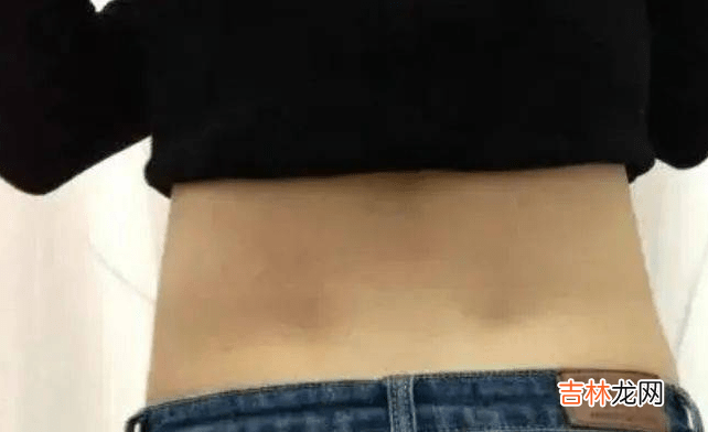 女人后腰上的“两个凹点”到底是什么？并不是每个人都有，要珍惜