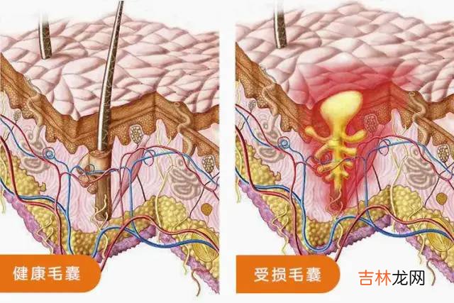 脱发终于有救了！这百年老字号，防脱又育发，谁用谁夸