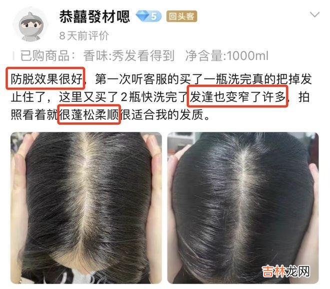 脱发终于有救了！这百年老字号，防脱又育发，谁用谁夸