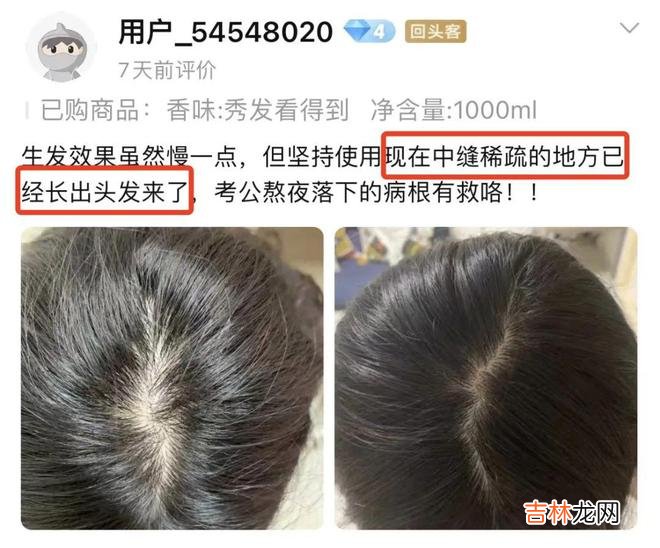 脱发终于有救了！这百年老字号，防脱又育发，谁用谁夸