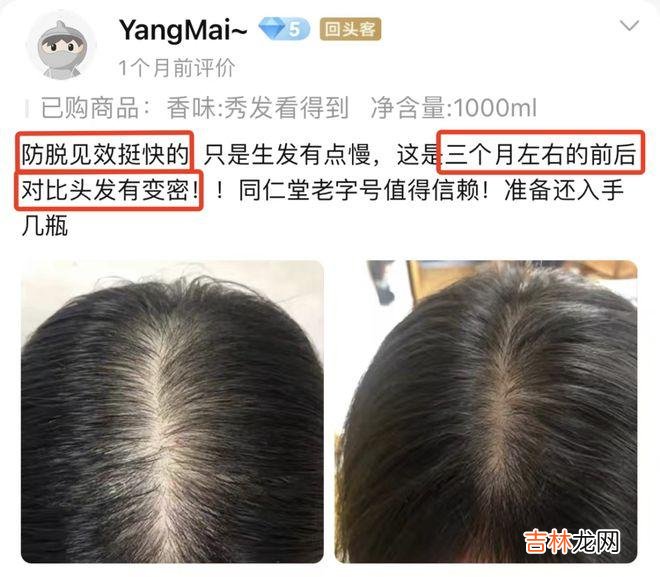 脱发终于有救了！这百年老字号，防脱又育发，谁用谁夸