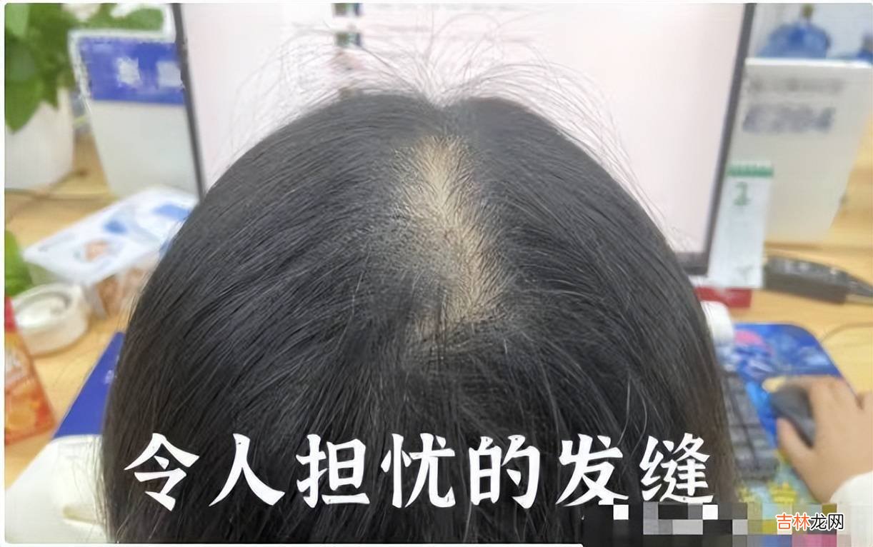 长期上班真会变丑吗？网友晒对比图，肉眼可见的沧桑，打工人哭了