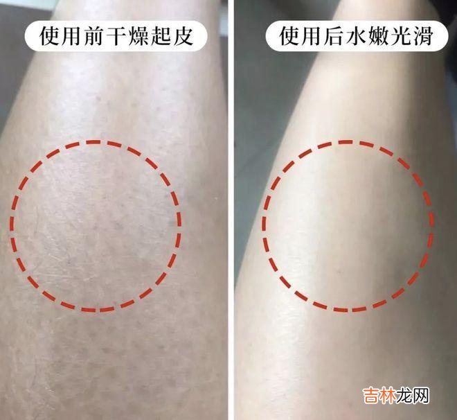 拯救老寒腿！入秋这样穿，自带小暖炉，让你又瘦又暖