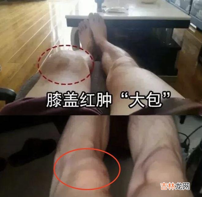 拯救老寒腿!入秋这样穿,自带小暖炉,让你又瘦又暖