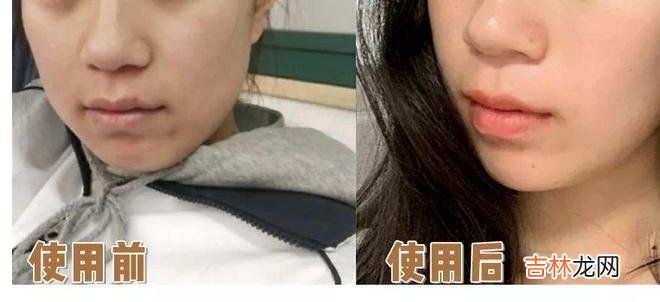 女人手脚冰凉？湿气重？睡前这样做，祛湿驱寒、养出好气色