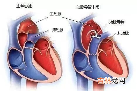 叔叔夸我乖巧懂事，却转头问爸爸：“你们真的不考虑再要一个吗？”