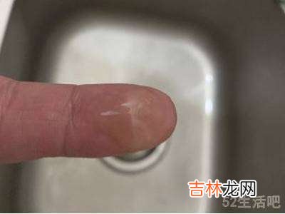 眼镜绿锈怎么清理?