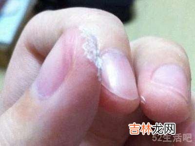 手上沾上520胶水怎么洗掉?