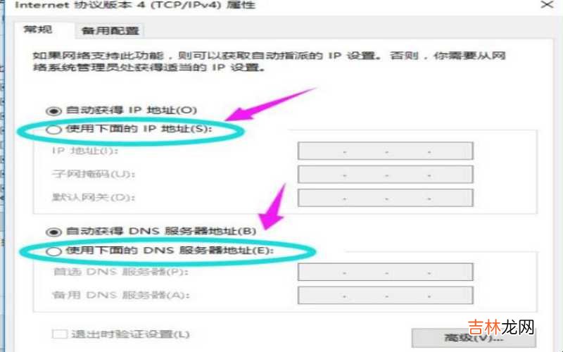 怎么设置电脑IP地址?