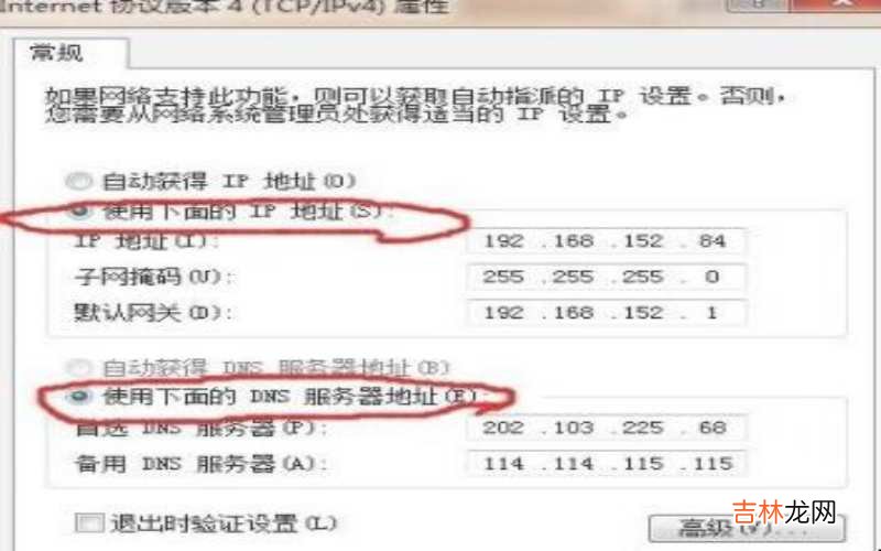 电脑静态ip地址怎么填写?