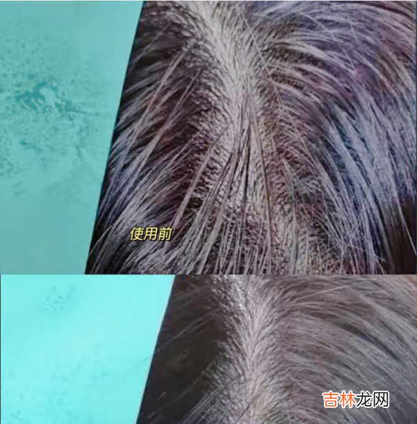 三谷424洗发水成分表_三谷进化论424洗发水成分表