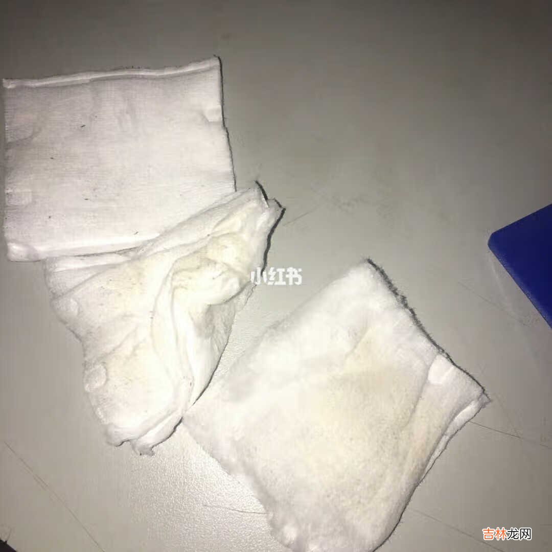娥罗纳英H软膏,好用到不得不推。 娥罗纳英H软膏,真心好用,我的天啊