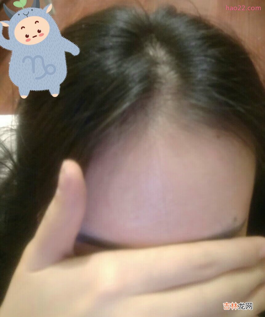 一直困扰我的脱发，丰添洗发水使用记录，一直更新 掉头发掉到怀疑自己得病