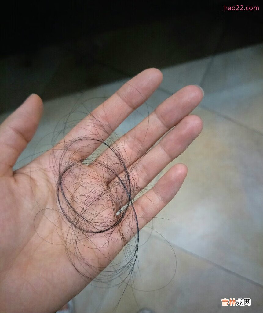 一直困扰我的脱发，丰添洗发水使用记录，一直更新 掉头发掉到怀疑自己得病