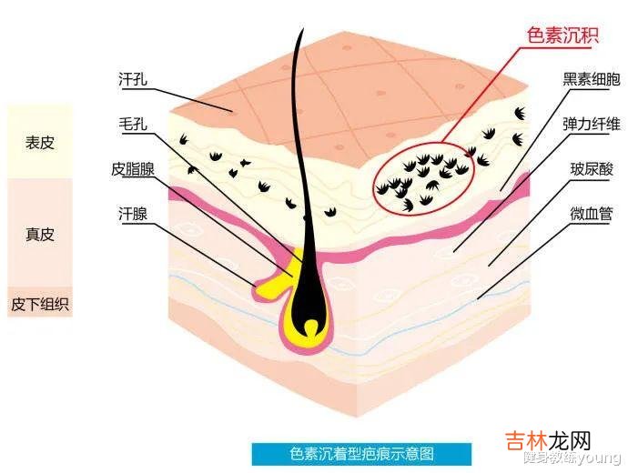 过敏 护肤高端玩家鲜为人知的5大护肤习惯