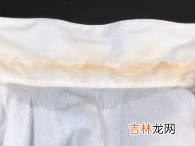 衬衣领子发黄怎么洗小窍门?