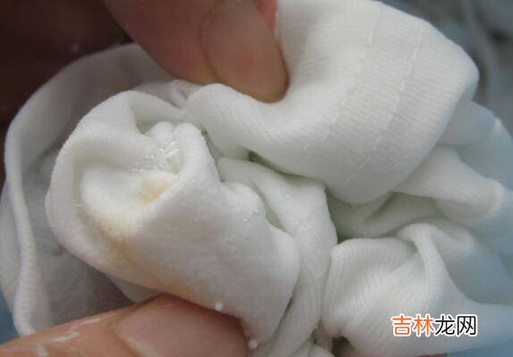 羊剪绒大衣发黄怎么洗白小妙招?