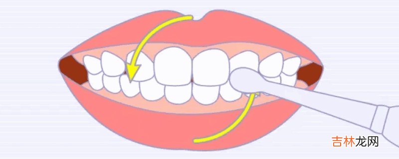 圆弧刷牙法?