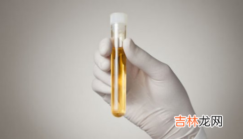 为什么收孕妇尿的不收我呢尿 为什么最近有人收孕妇尿液
