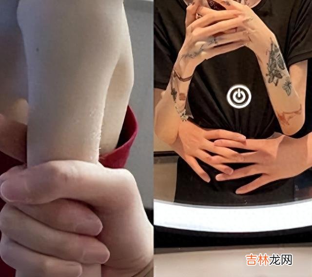 pua 她被男友PUA、排泄难控穿纸尿裤！如今瘦成“皮包骨”，体重60斤