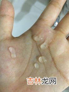 水光针后面膜要不要洗,水光针后天天敷面膜不洗脸可以吗