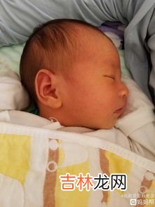 怎么晒黄疸,新生儿究竟应该怎么科学去黄疸？通过晒太阳的方式有效吗？